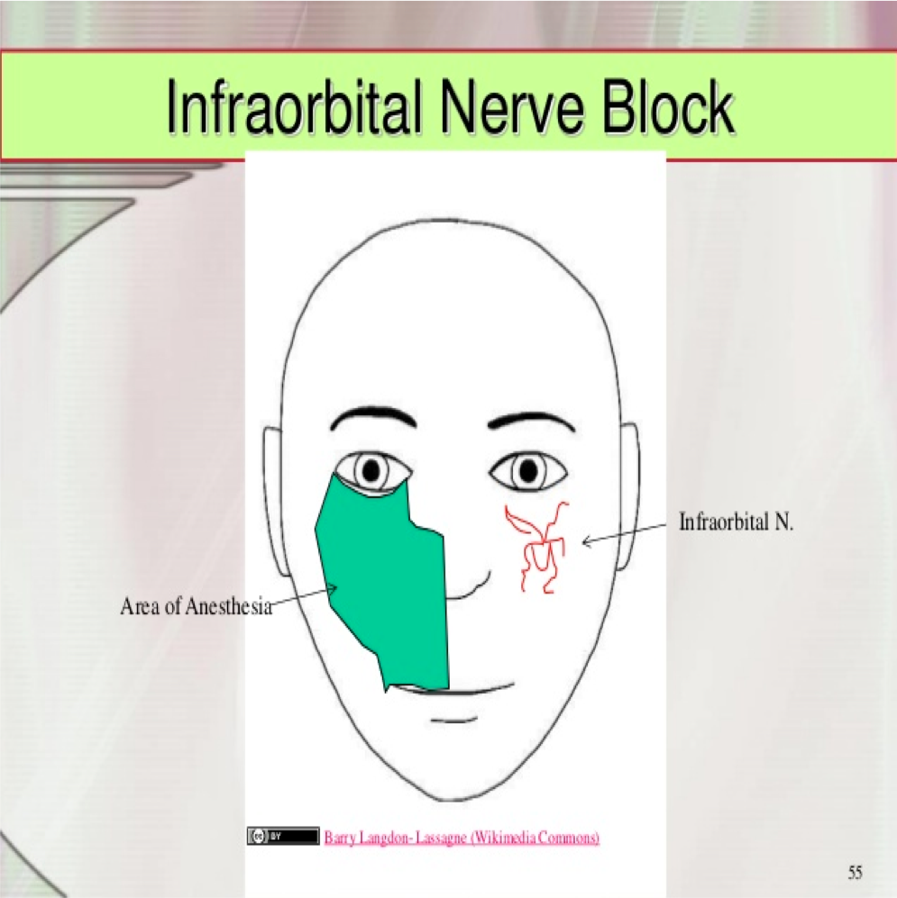 Procedure Lab – EM Ninja